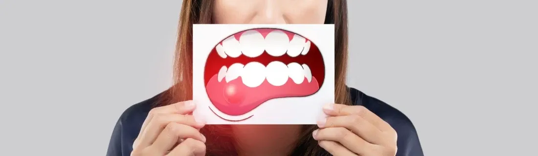 Oral Cancer Screenings